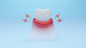 가양역임플란트 치은염 설명을 위한 이미지