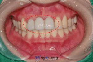치료를 위해 방문 했을 당시 이미지