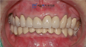 치료 종결 이미지