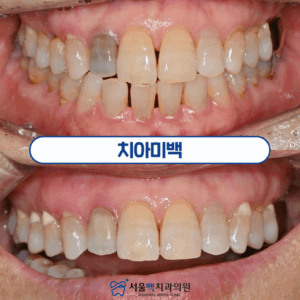 가양동치료 타이틀