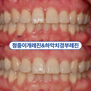 가양역치과