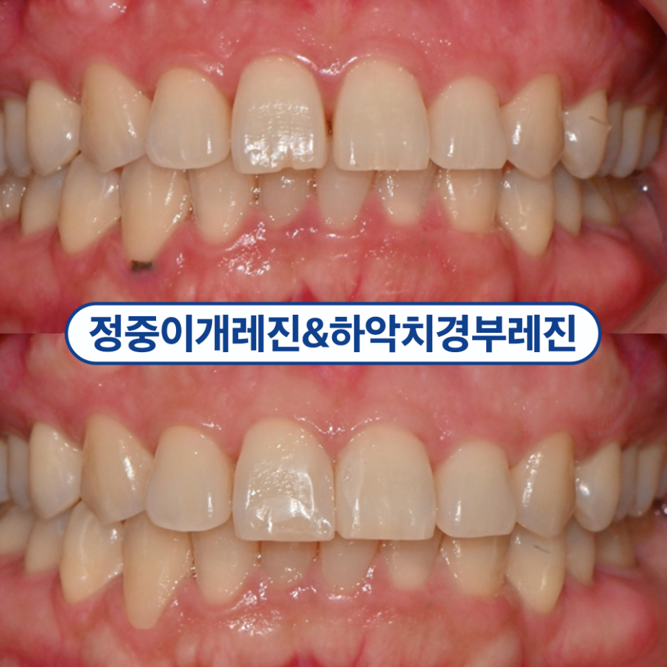 가양역치과