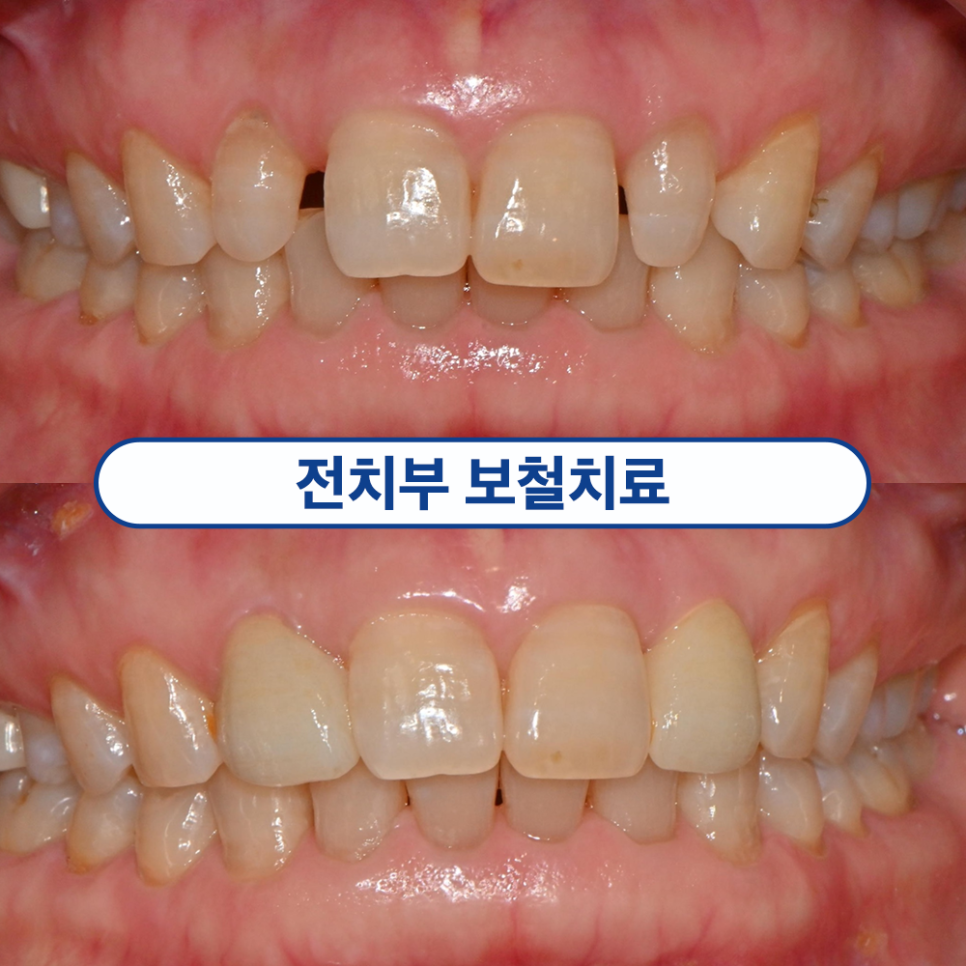 가양역치과