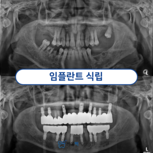 가양역치과